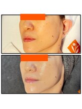 ピュアグレース 自由が丘/50代からのお肌改善☆