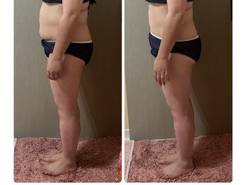 ヨサ パーク コアハート(YOSA PARK CORE HEART)