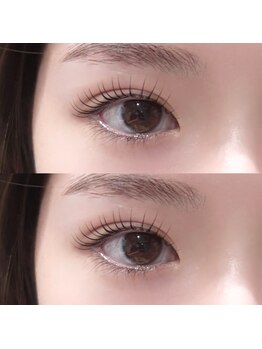 アネラ 表参道(Anela)/