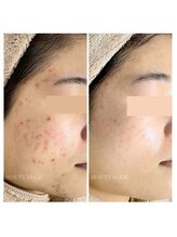 ビューティーホリック 蘇我店(BEAUTY HOLIC)/