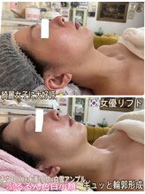 アルページュ(Arpege)/一撃級の変化と持続が人気◎