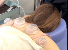 整体院 結灯(ユイトウ)/【カッピング風景】