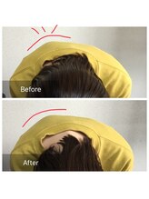 加良多屋(からだや)/背中のでっぱりが減少！