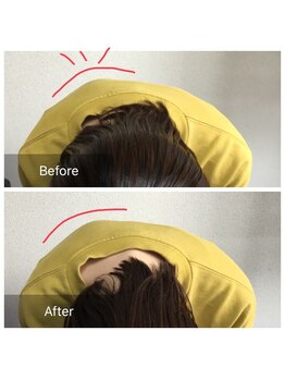 加良多屋(からだや)/背中のでっぱりが減少！