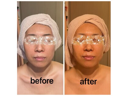 ディグニータココ 自由が丘(DIGNITA coco)の写真