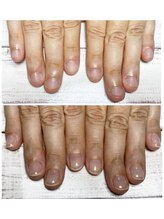 ミオンネイル(mion nail)/自爪育成クリア
