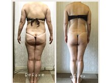 ラヴィアンローズ 忠節店(La vie en Rose)の雰囲気（【痩ボディ】お悩みに合わせてしっかり流していきます）