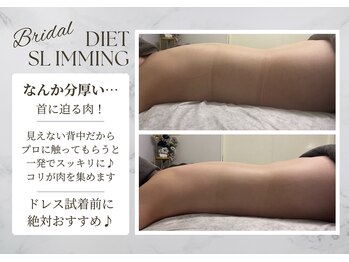 サロンドエリ ラクロワジエール(Salon d’ERI la Croisiere)/肩こりも分厚い背中の原因です