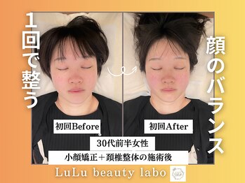 ルルラボ(LuLu beauty labo)/美しさを引き出す小顔矯正
