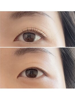 リコット バイ カシータ(Recot by casita)の写真/【瞼にアプローチ】特殊技術で瞼のリフトアップを叶えます。目元がスッキリした仕上がりに！