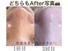 【頑固な黒ずみ徹底ケア】話題の韓国式３D毛穴洗浄＋毛穴引き締めケア