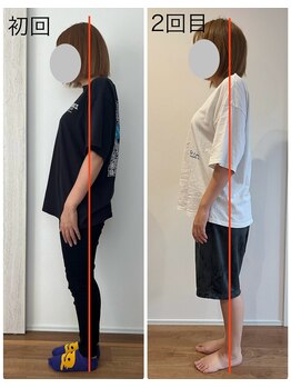 リアン(Liam)/姿勢改善/美容整体