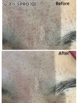 ベルミーランド イオン長浦/