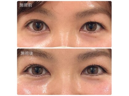 ラフィーユ うるま店(Lafille)の写真