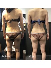 ピーラトゥ 日立(P-Ratu)/ブライダルコース