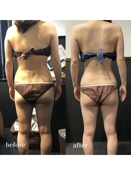 ピーラトゥ 日立(P-Ratu)/ブライダルコース