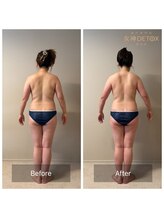 女神デトックス 西宮店(女神DETOX)/ビフォーアフター