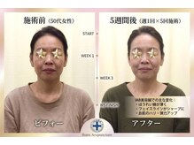 井原鍼灸整骨院/IAB美容鍼