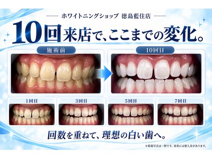 ホワイトニングショップ 徳島藍住店の写真