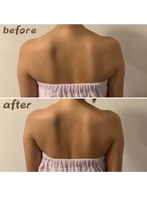 ルアナ 北谷店/リンパマッサージ 《沖縄/北谷》