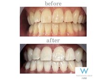 ホワイトニングショップ 八代店/