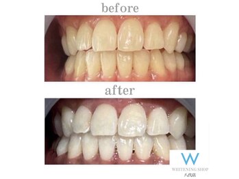 ホワイトニングショップ 八代店/