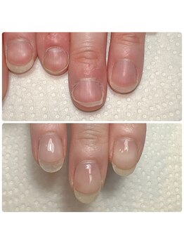 スマイルニコ(smile nico)/横長が縦長爪に