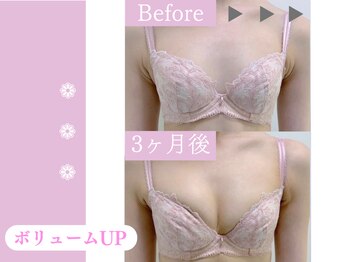 キアナ 横浜店(Kiana)/バストアップBefore After