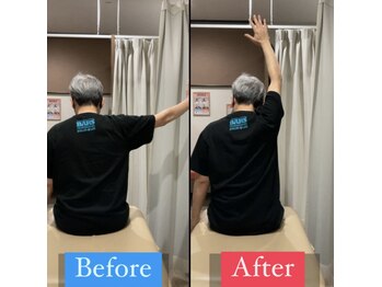 ナオル整体 宮崎院(NAORU整体)/50代男性施術事例【肩痛改善】