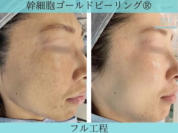 リメイク 広尾(REMAKE)/