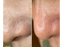 サイ(Sai)/before⇒after