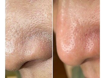 サイ(Sai)/before⇒after