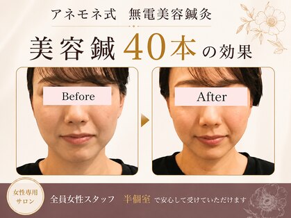 アネモネ 心斎橋院の写真