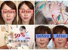 レフアつつじヶ丘整骨院
