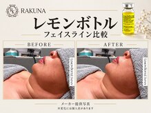ラクナ(RAKUNA)の雰囲気（【顎・二の腕スッキリ/韓国で大人気のメニューレモンボトル】）