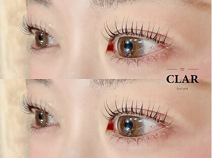 クラル(CLAR)の写真