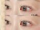 クラル(CLAR)の写真