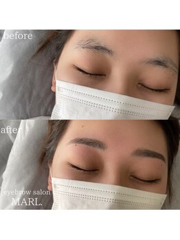 マール(MARL.)/ハリウッドブロウリフト