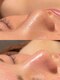 ホワイトラボ 堺東(White labo)の写真/【韓国肌管理】憧れの韓国人のような"艶肌"を目指す＊肌の悩みに合わせた美容液を導入し徹底ケア！