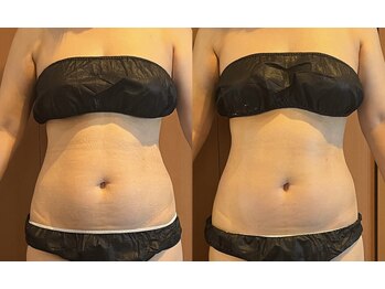 クレール(Claire)/夏までにくびれボディへ♪