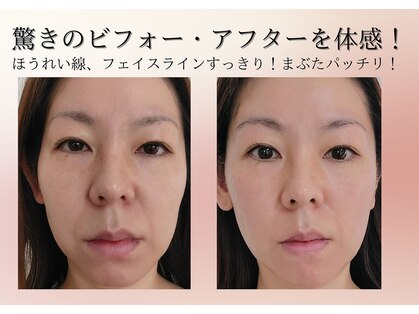 エボルブ 四条烏丸店(EVOLVE)の写真