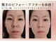 エボルブ 四条烏丸店(EVOLVE)の写真