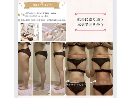 ウェリナ(Welina)の写真