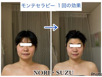 ノリスズ(NORI SUZU)/当サロン独自の頭蓋骨と顔の矯正