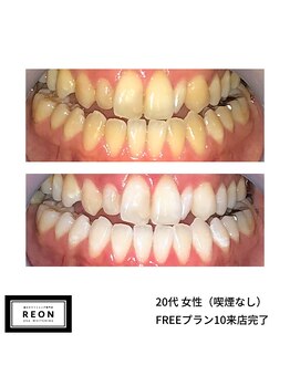 レオン 磐田(REON)/◇ お客様 before＆after ◇