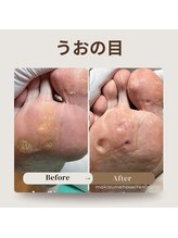 巻き爪補正店 那覇店/