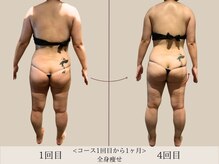 エル 麻布十番(LllL)/【痩身】1ヶ月ビフォアフ