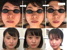 サロンチオリ 烏丸(Salon Chiori)の雰囲気（《小顔とたるみ改善の早道》全身矯正で輪郭を整え肌を引き上げる）