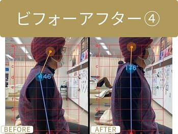 郡山駅西口整体院/ビフォーアフター４