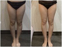 美容整体 ウェリナ 蟹江院/小顔矯正/骨盤矯正/美脚サロン 